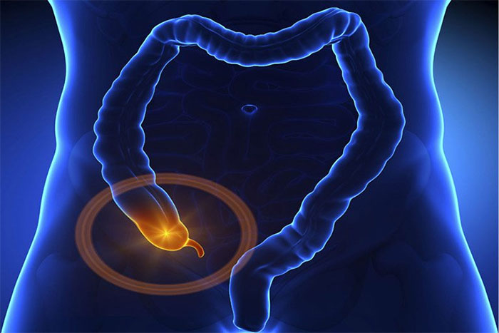 Small bowel obstruction: causes, symptoms and treatment Picture 1