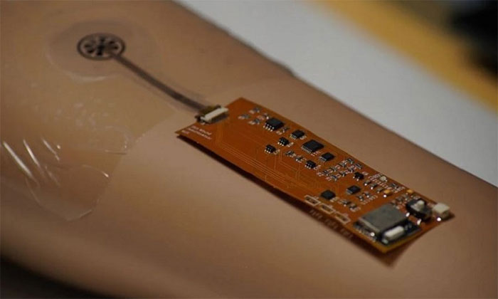 Smart bandages help patients recover from a distance Picture 1