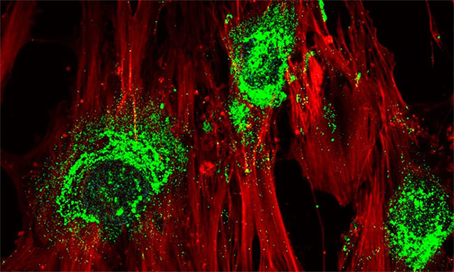 Picture 3 of Stem cell therapy combined with sound waves can help broken bones grow back