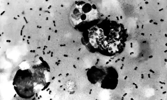 Successfully deciphering the secret of the origin of the Black Death Picture 1