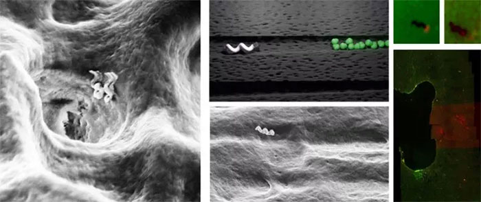 Picture 2 of Successfully researched nano-sized robot to destroy bacteria in tooth pulp