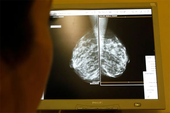 Picture 1 of Sweden develops antibody with potential to treat cancer
