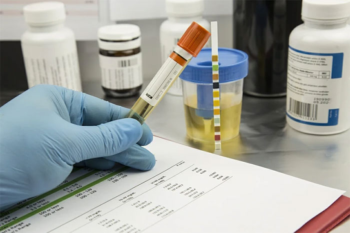 Picture 1 of Testing equipment detects 40 types of drugs in just... 3 minutes