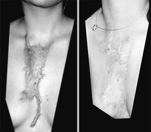 The 'DNA specter' effect - proving the existence of a human body in another dimension? Picture 6