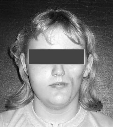 The 'DNA specter' effect - proving the existence of a human body in another dimension? Picture 7