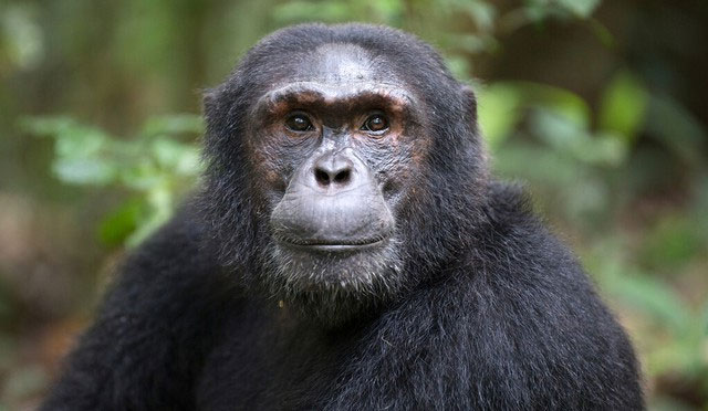 The human brain has immune cells that separate us from primates, but it is also a weakness Picture 2