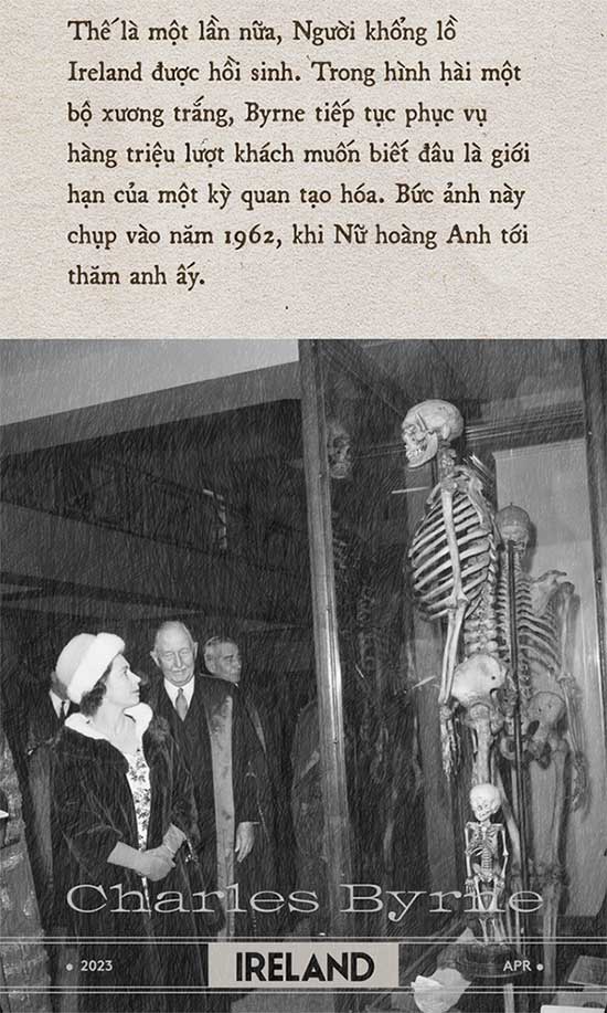 Picture 12 of The Irish Giant: The Most Controversial Tragedy in British History