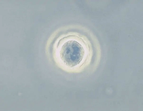 Picture 6 of The most dangerous human parasites ever discovered