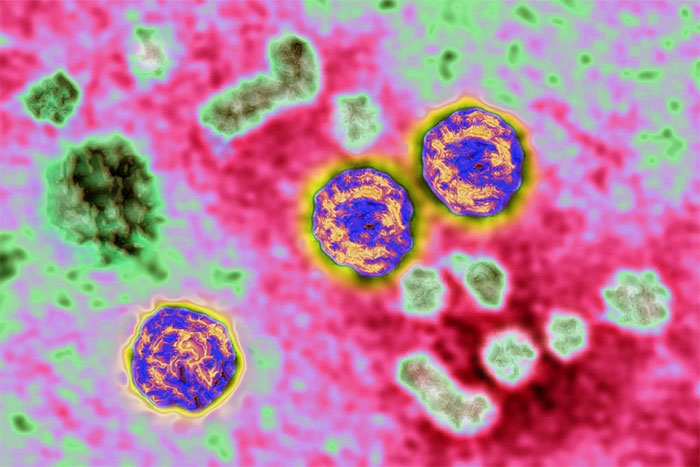 The new 'suspect' of the mysterious wave of hepatitis Picture 2