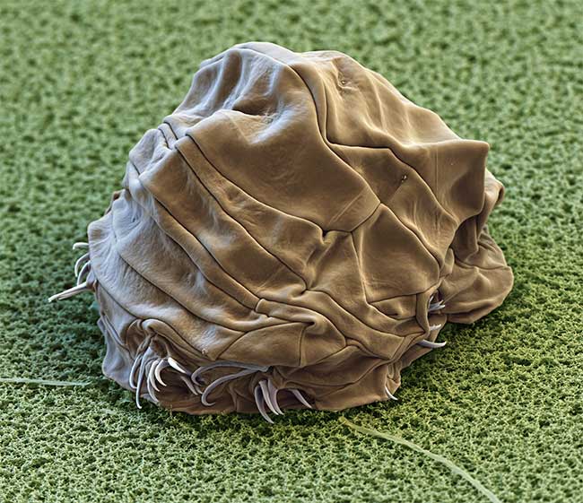 Picture 3 of The Secret of the Immortal Tardigrade: A Creature That Fears No Challenge!