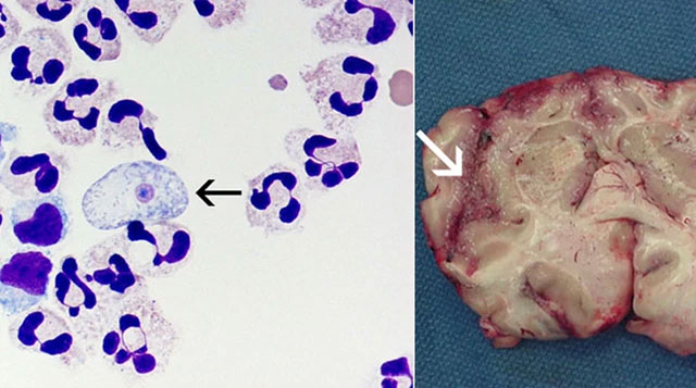 The strangest parasites in the animal world Picture 5