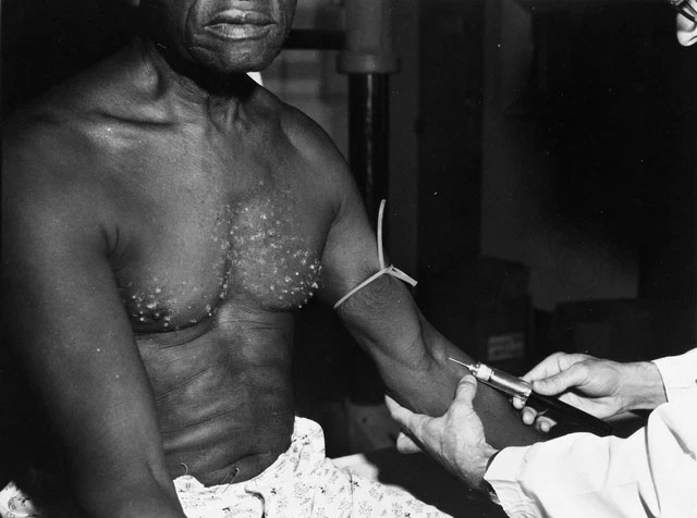 The Tuskegee Experiment: One of History's Most Unethical Projects Picture 5
