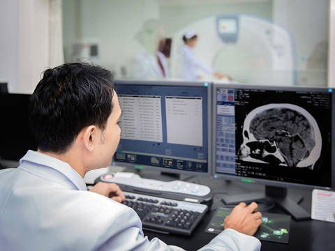 Picture 2 of Things to know about cerebral infarction