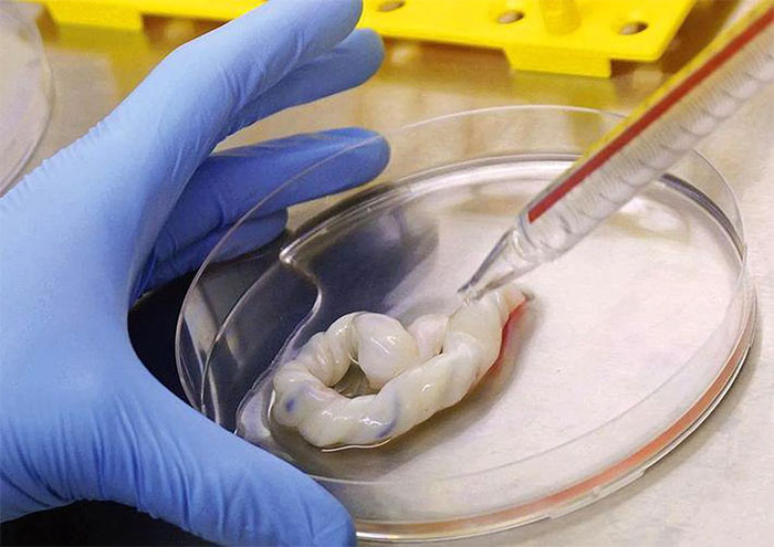 Picture 2 of Things to know about stem cells from umbilical cord blood