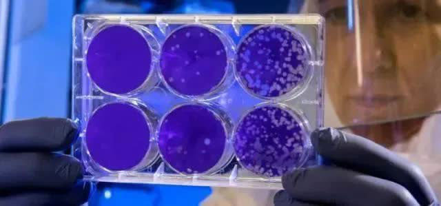 This cancer cell has been nurtured for 70 years, the volume alone is more than 50 million tons Picture 3