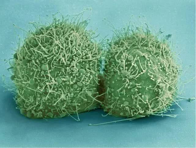 This cancer cell has been nurtured for 70 years, the volume alone is more than 50 million tons Picture 5