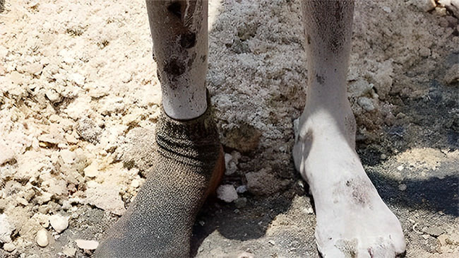 Picture 2 of This is one of the most toxic jobs in the world: Working for 3 years can make you blind and deaf, and turn your skin from black to white.