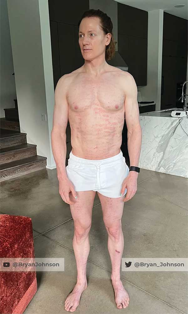 To live to 200 years old, billionaire Bryan Johnson is testing a new method of longevity. Picture 5