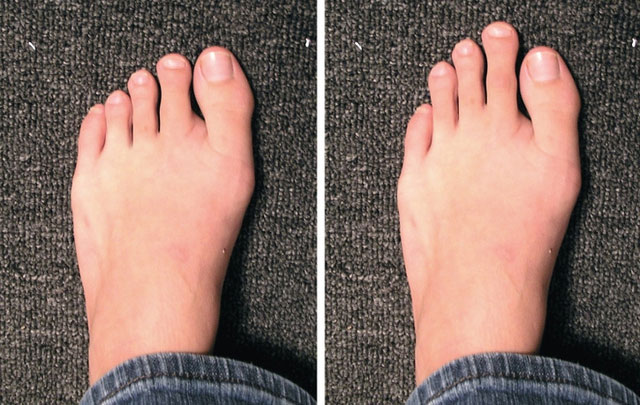 Top 12 body features that seem normal but are rare, not everyone can own Picture 10