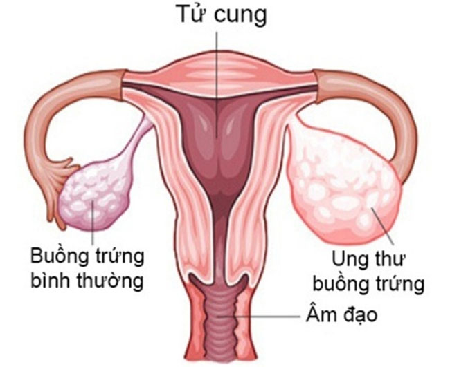Picture 4 of Top 14 most dangerous cancers today