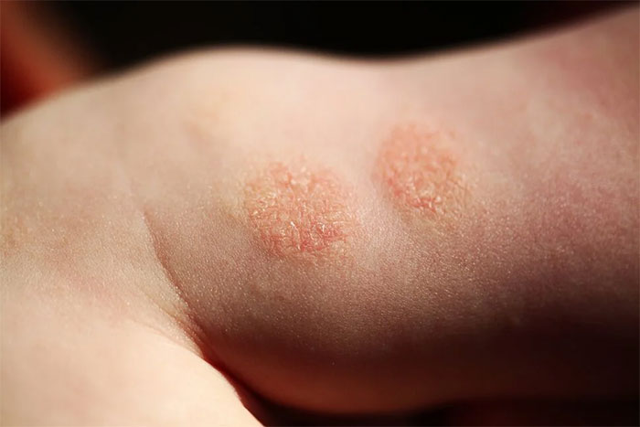Picture 2 of Top 15 'super small' signs of cancer that many people ignore
