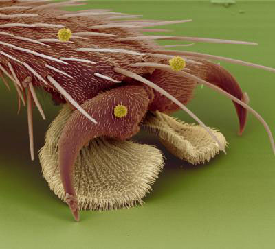 Picture 10 of Top 25 common items that look different under a microscope