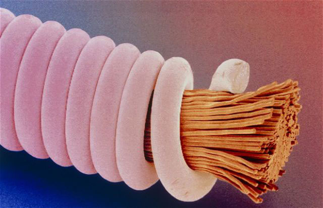 Picture 12 of Top 25 common items that look different under a microscope