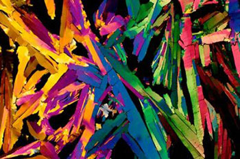 Picture 15 of Top 25 common items that look different under a microscope