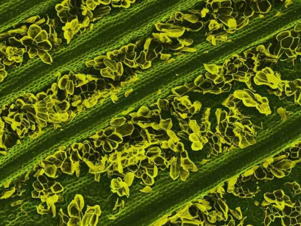 Picture 16 of Top 25 common items that look different under a microscope