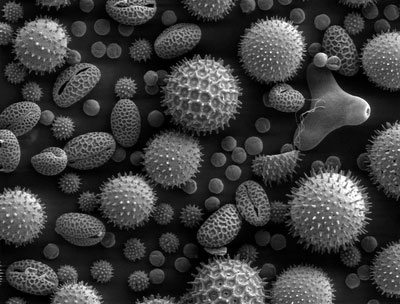 Picture 17 of Top 25 common items that look different under a microscope