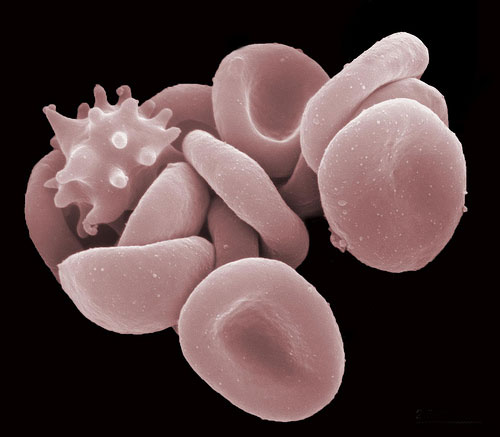 Picture 2 of Top 25 common items that look different under a microscope