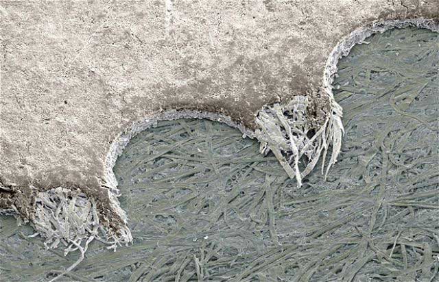 Picture 21 of Top 25 common items that look different under a microscope