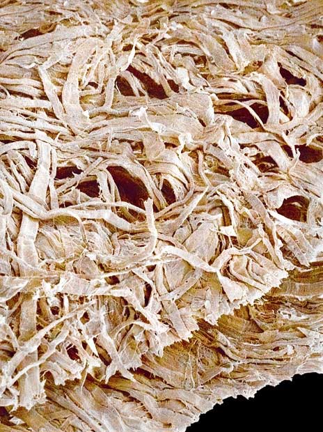 Picture 22 of Top 25 common items that look different under a microscope