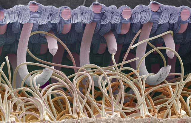 Picture 24 of Top 25 common items that look different under a microscope