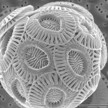 Picture 4 of Top 25 common items that look different under a microscope