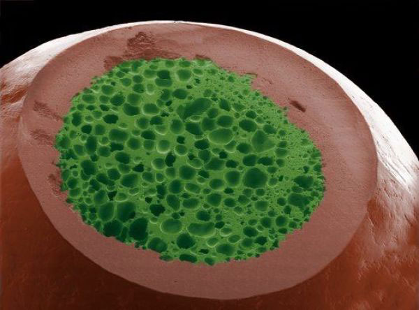 Picture 5 of Top 25 common items that look different under a microscope
