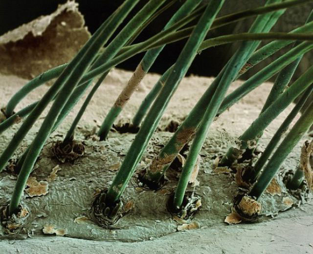 Picture 8 of Top 25 common items that look different under a microscope