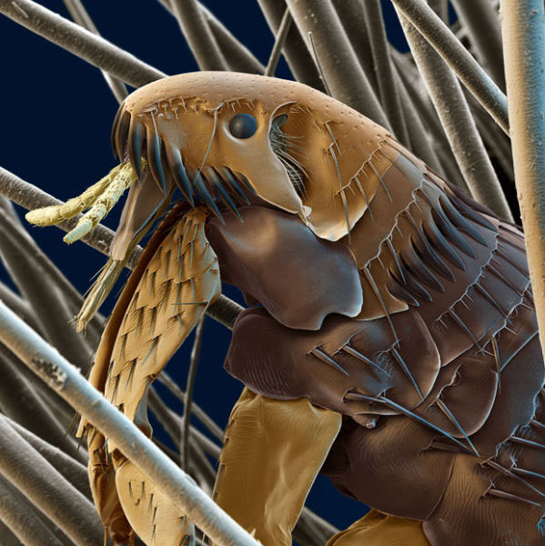 Picture 9 of Top 25 common items that look different under a microscope