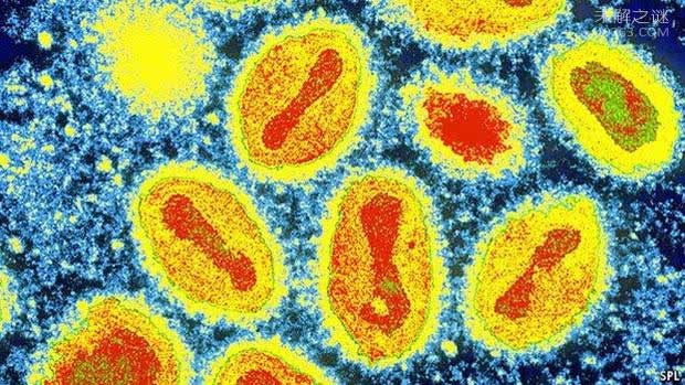 Top 7 most terrifying infectious diseases in human history Picture 7