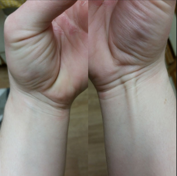 Picture 7 of Top 7 unique mutant features on the body that very few people in the world are fortunate to possess