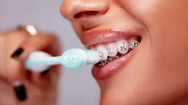 Picture 2 of Top 9 interesting facts about teeth that may surprise you