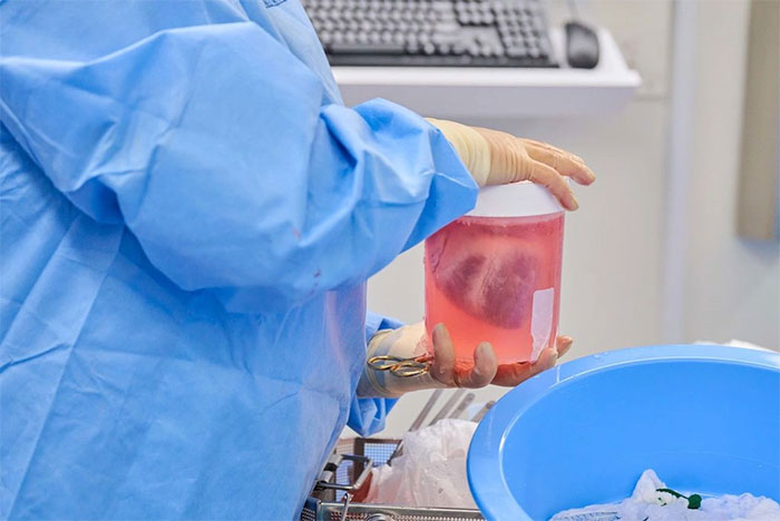 Two brain dead people receive pig heart transplants Picture 1