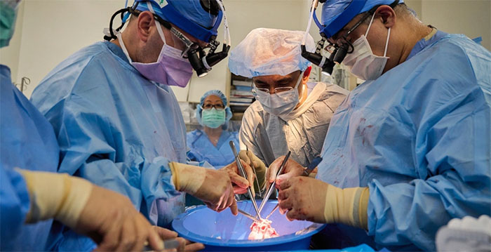 Two brain dead people receive pig heart transplants Picture 4