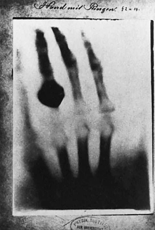'Unveiling' the painful truth behind the experiment that created the world's first X-rays Picture 2