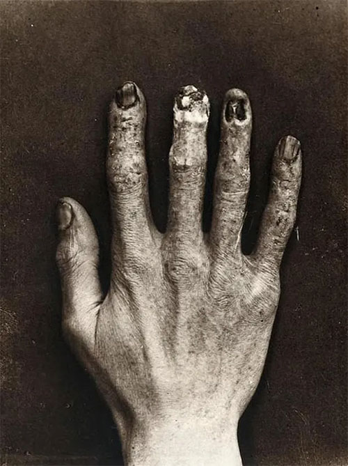'Unveiling' the painful truth behind the experiment that created the world's first X-rays Picture 3