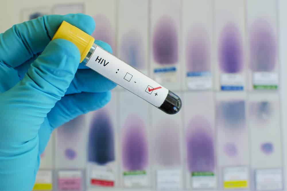US scientists develop a method to destroy the latent HIV virus in cells Picture 1