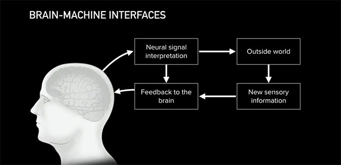 Picture 4 of What is Neuralink? Can Neuralink 'cure' tinnitus as Elon Musk claims?