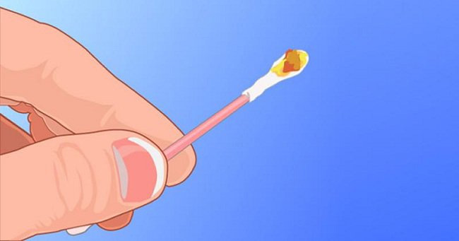 What is normal earwax? Picture 2