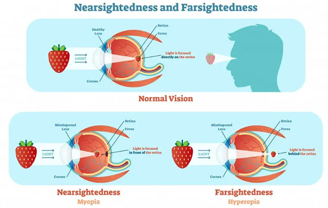 What is special about fish eyes to make them see clearly underwater? Picture 3