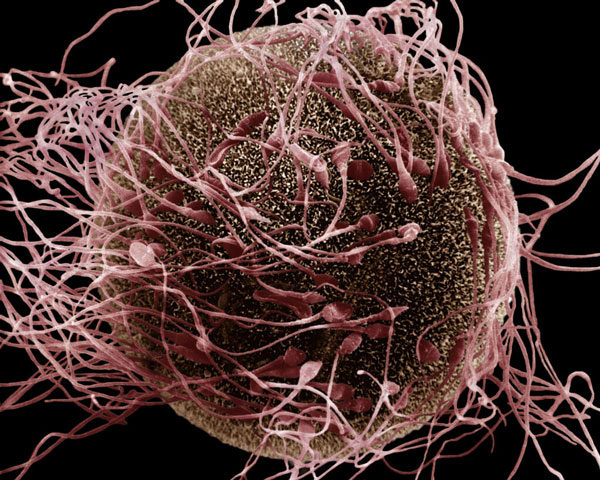 Picture 3 of Where do viruses come from and are they living things?